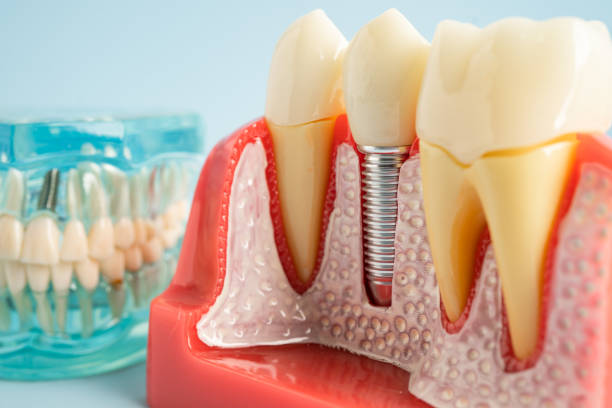 Best Root Canal Treatment  in Taneytown, MD